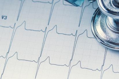 Stethoskop und EKG-Linie